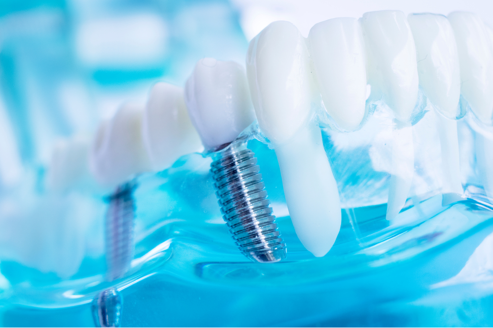 Dentist dental teet